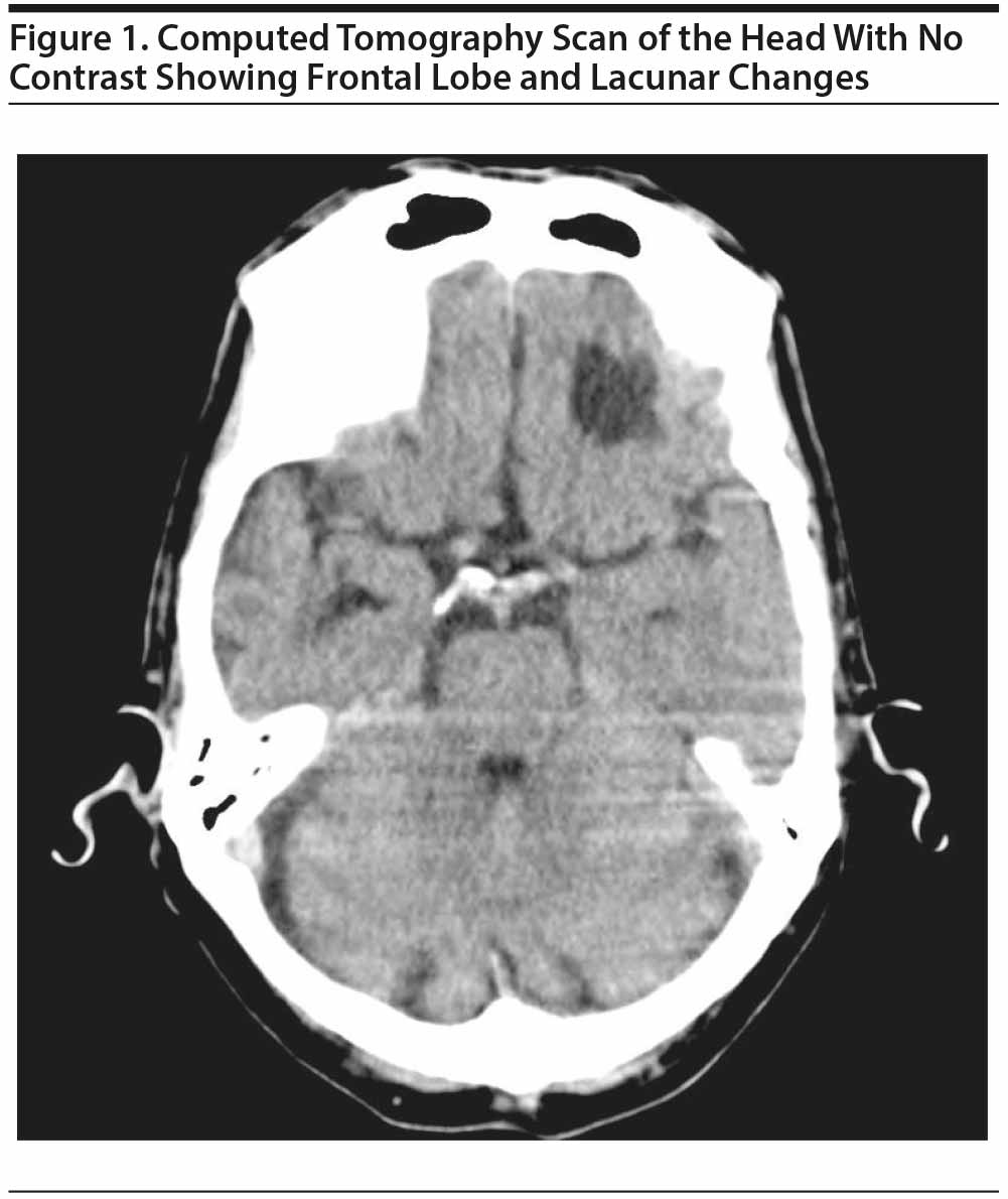 Figure 1