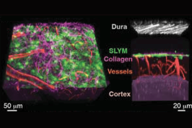 Newly identified SLYM splits the subarachnoid space into an outer compartment and a vessel-rich inner compartment.