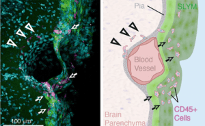 CNS immune cells use SLYM as a platform close to the brain's surface to monitor CSF for signs of infection.