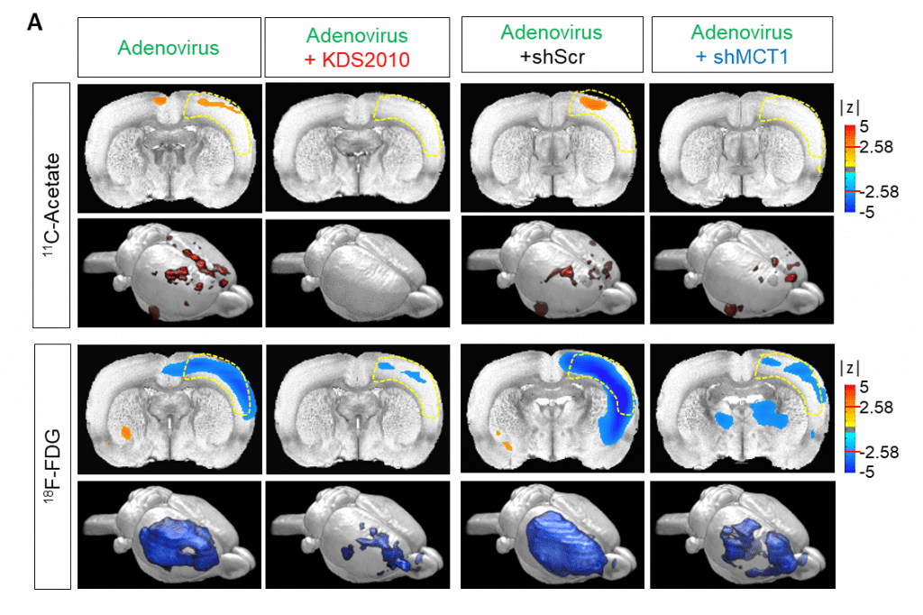 Comparison of C-acetate and 18F-FDG PET imaging in an adenovirus model with different treatments and genetic modifications.