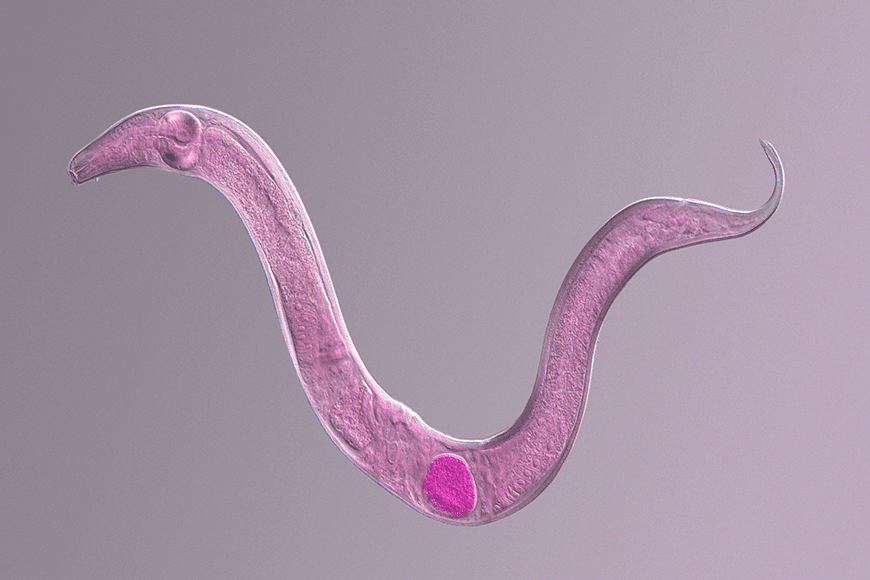A 64-year-old Australian woman was diagnosed with a rare Ophidascaris robertsi parasitic worm infection likely caused by ingesting eggs while collecting vegetables near python habitats, leading to the worm migrating to her brain.