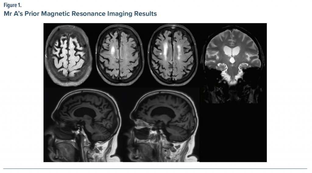 Figure-1 Mr A Prior Magnetic Resonance Imaging Results