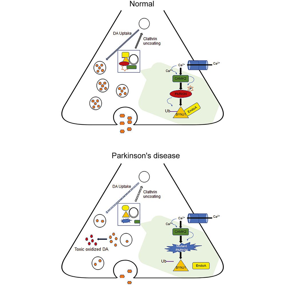 Parkinson’s disease-linked parkin mutation disrupts recycling of synaptic vesicles in human dopaminergic neurons