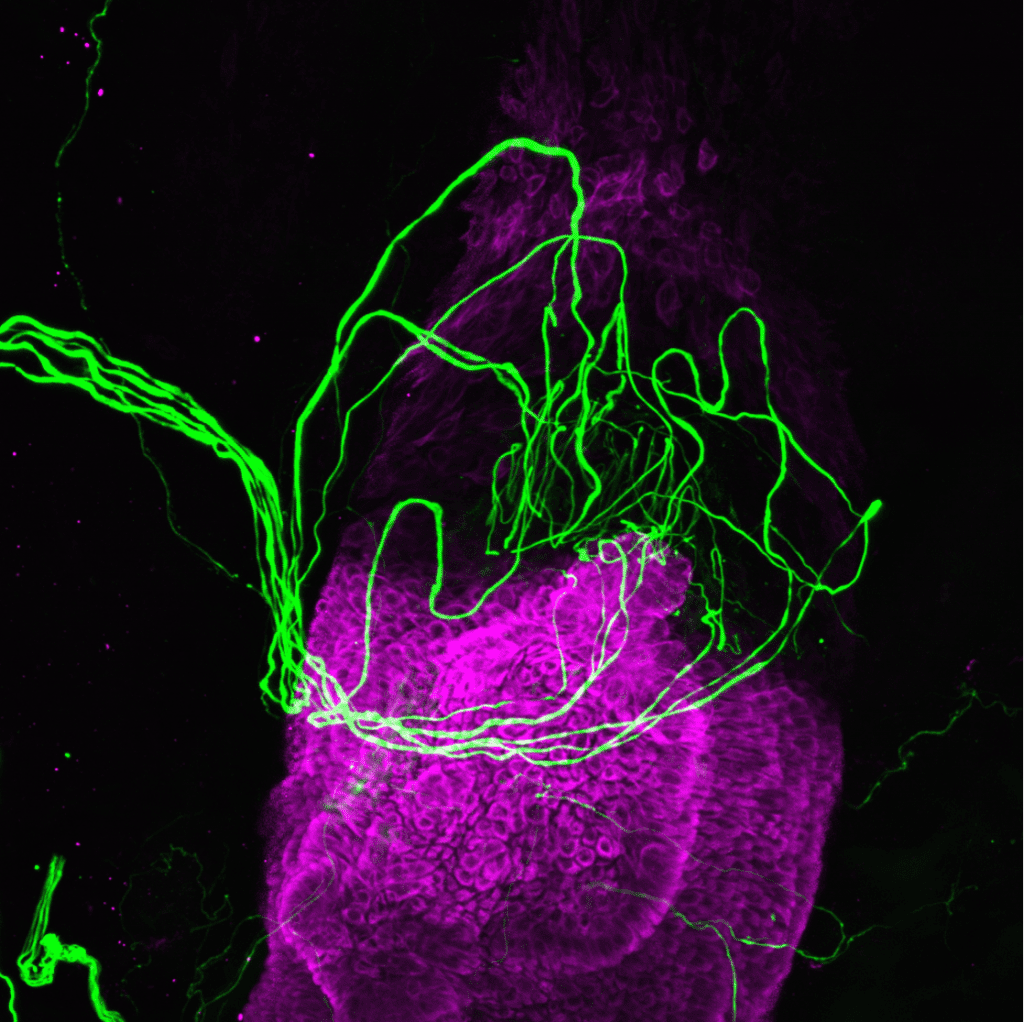 Researchers discover hair follicles have a unique role in sensing touch.