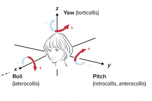 Severity of Antipsychotic-Induced Cervical Dystonia by Algorithm-Based Rating System