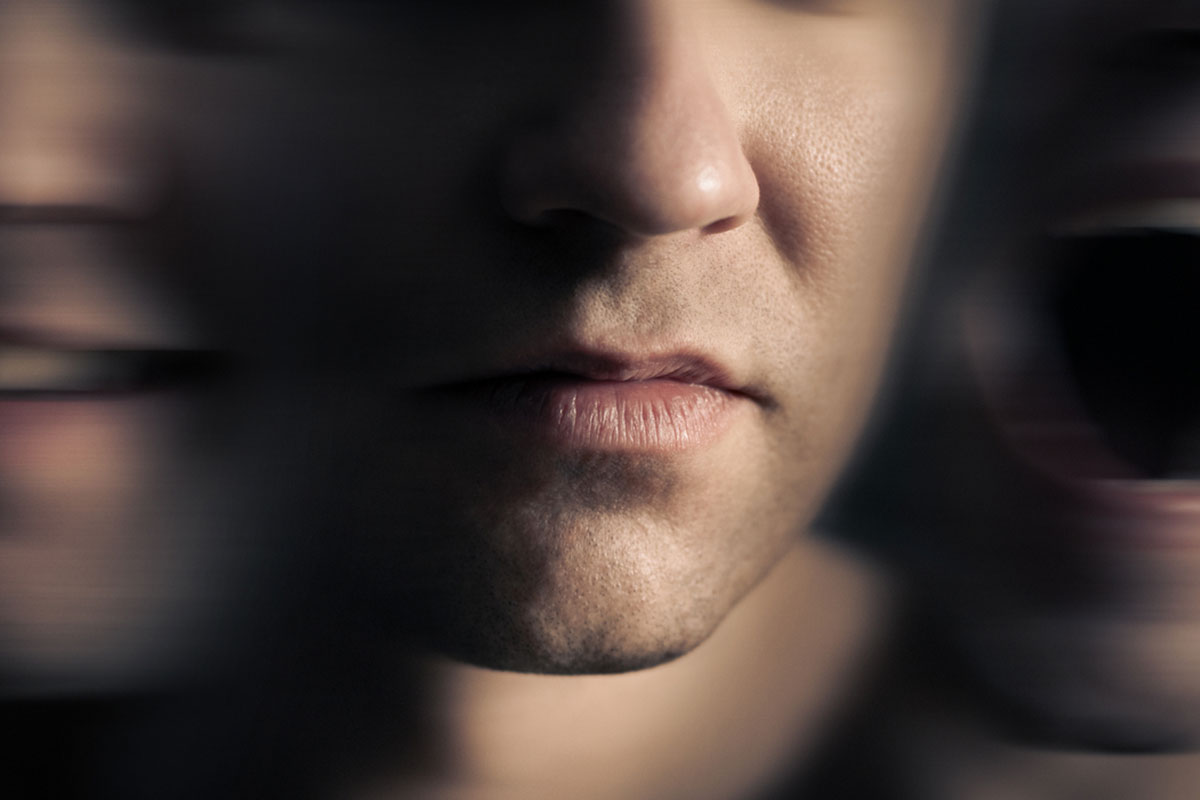 Calcineurin Inhibitor–Induced Psychosis