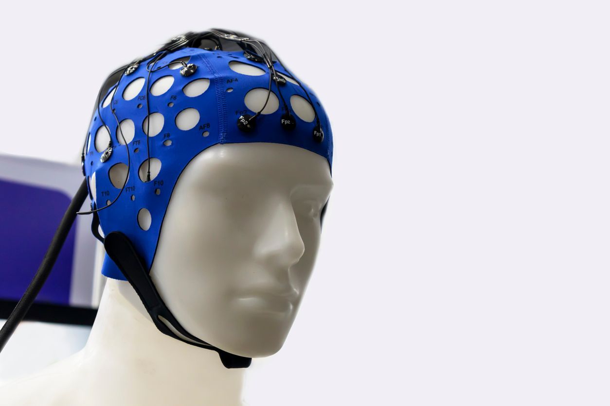 Administering ECT to the Critically Ill