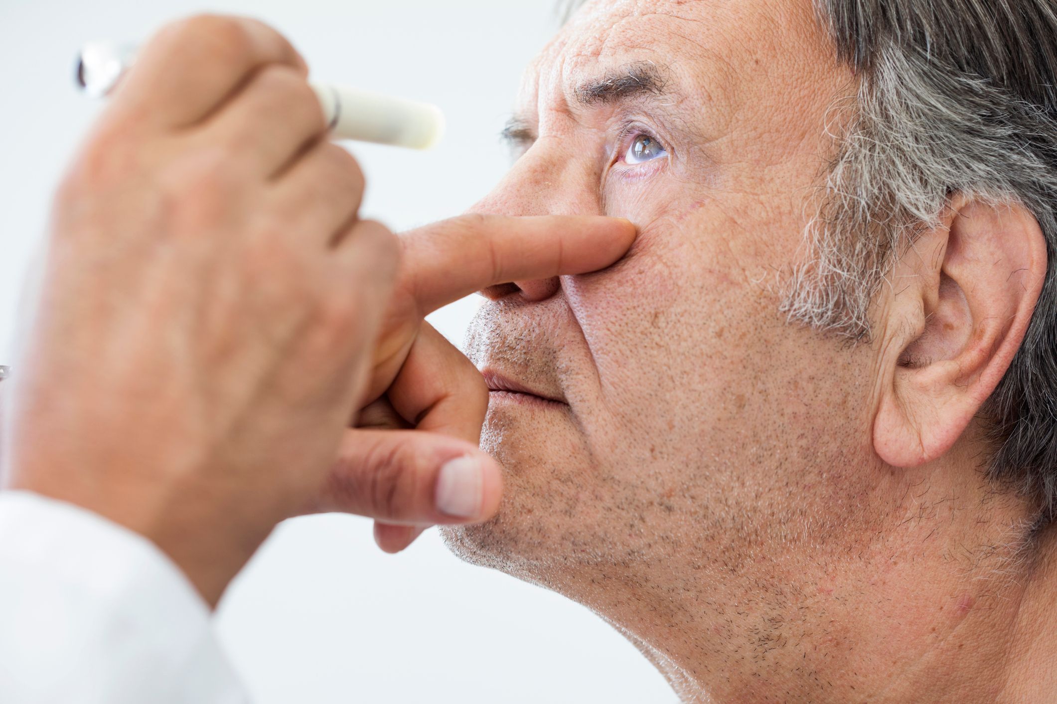 Visual Snow Syndrome and Bupropion